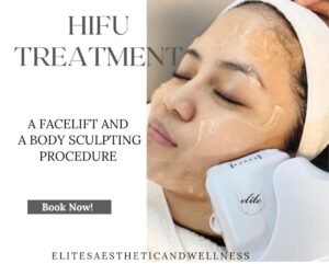 Hifu Treatment