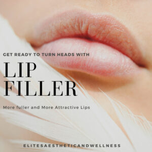 Lip Filler