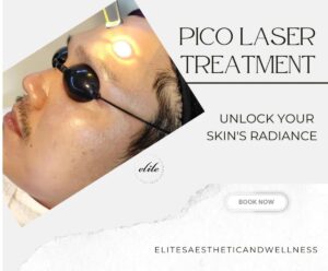 Pico Laser Treatment